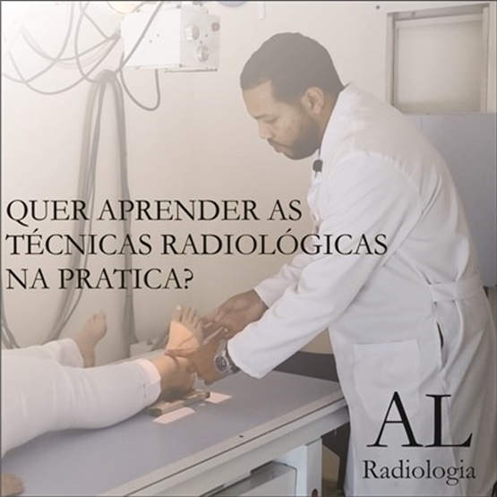 Anderson Lino