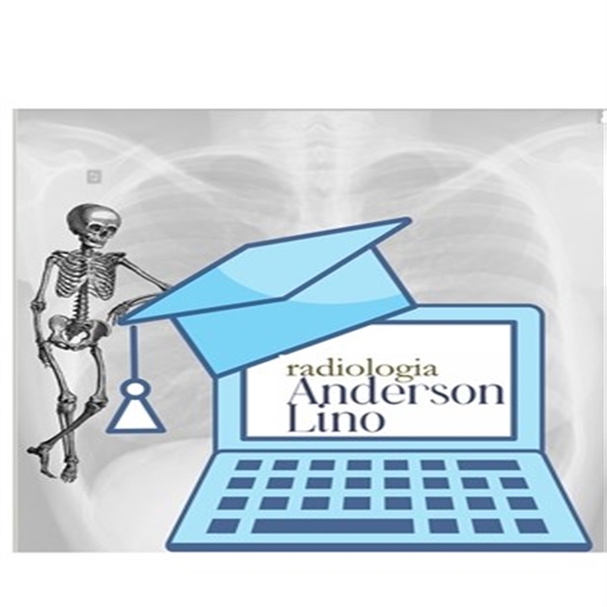 Anderson Lino